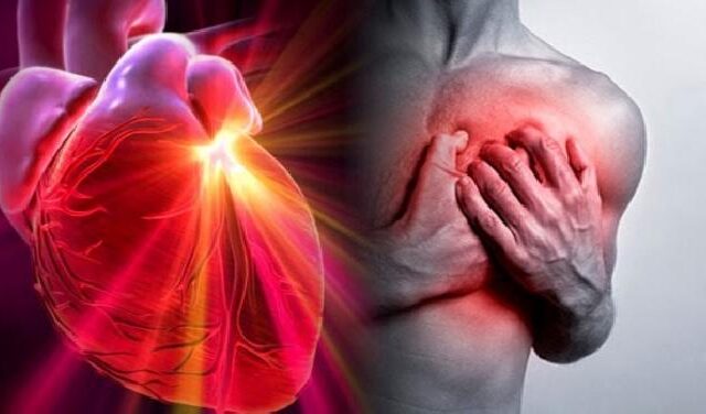 infarto sintomi caldo