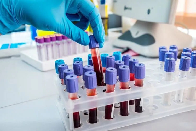 Coronavirus a Caserta: lo Spallanzani conferma la positività della 24enne