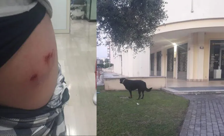 Ragazzino in monopattino attaccato da tre cani randagi, corsa in ospedale. FOTO