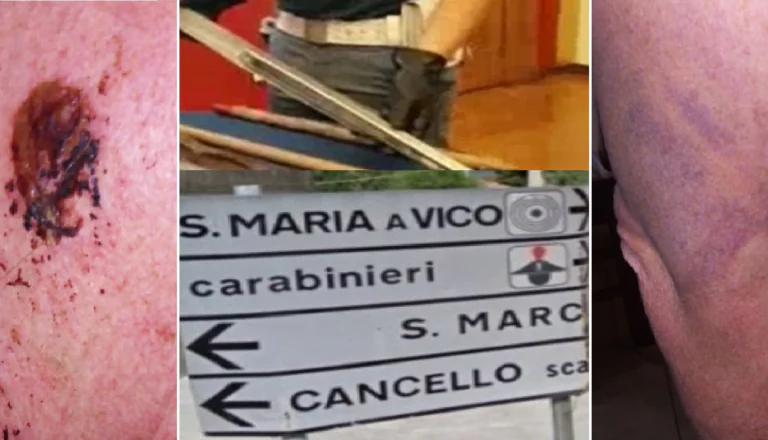 Moglie del ras presa a bastonate dalle figlie: “Hai tradito papà”. Spedita in ospedale (FOTO)