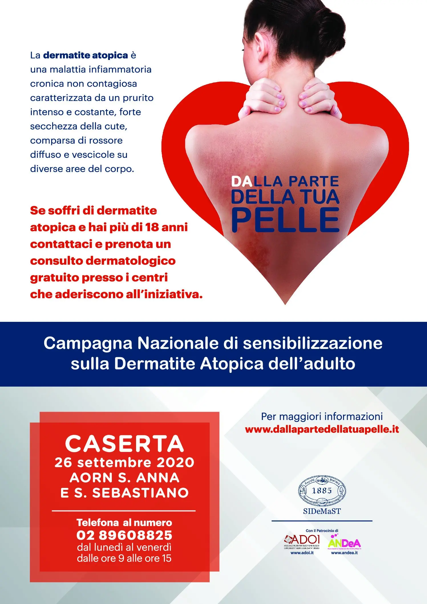 Dermatite atopica dell’adulto: il 26 settembre consulti dermatologici gratuiti a Caserta