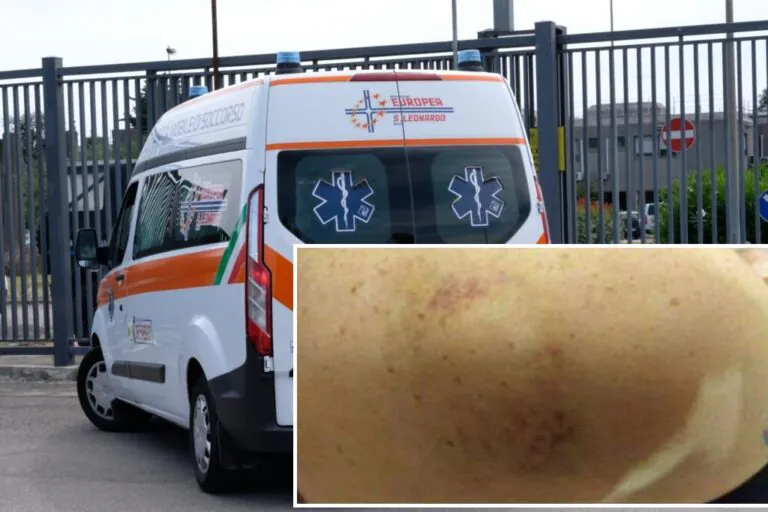 Muore a un mese da mattanza: prendeva oppiacei dopo orrore, c’è l’accusa di tortura