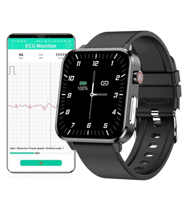 Smartwatch potentissimo in super sconto su Amazon: spunta il coupon e risparmia