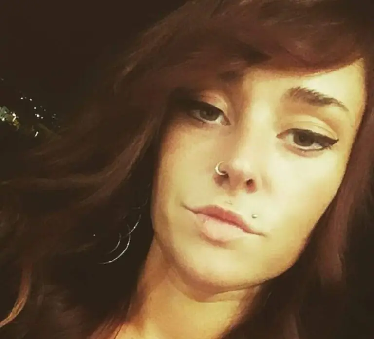 Muore a 30 anni dopo l’incidente fatale sull’Appia