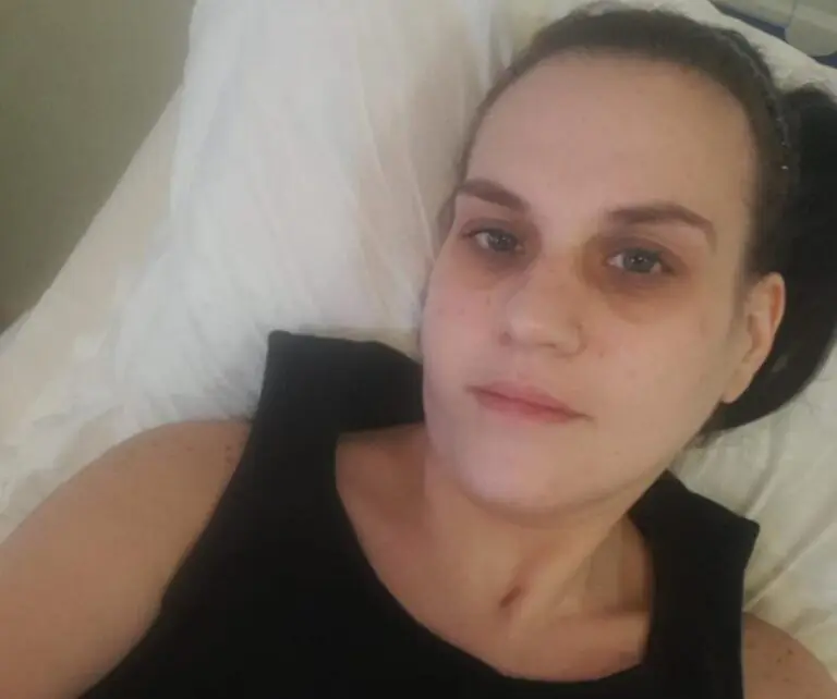 Angela torna a casa dopo 7 mesi in ospedale: “Ora vogliamo giustizia”
