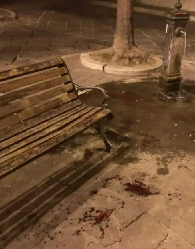 Sangue in piazza, 15enne accoltella coetaneo durante l’uscita. Foto