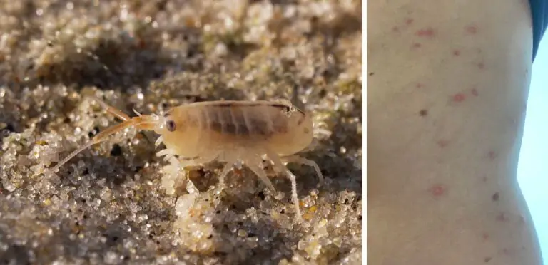 Invasione in spiaggia di pulci di mare: cosa fare se si viene punti
