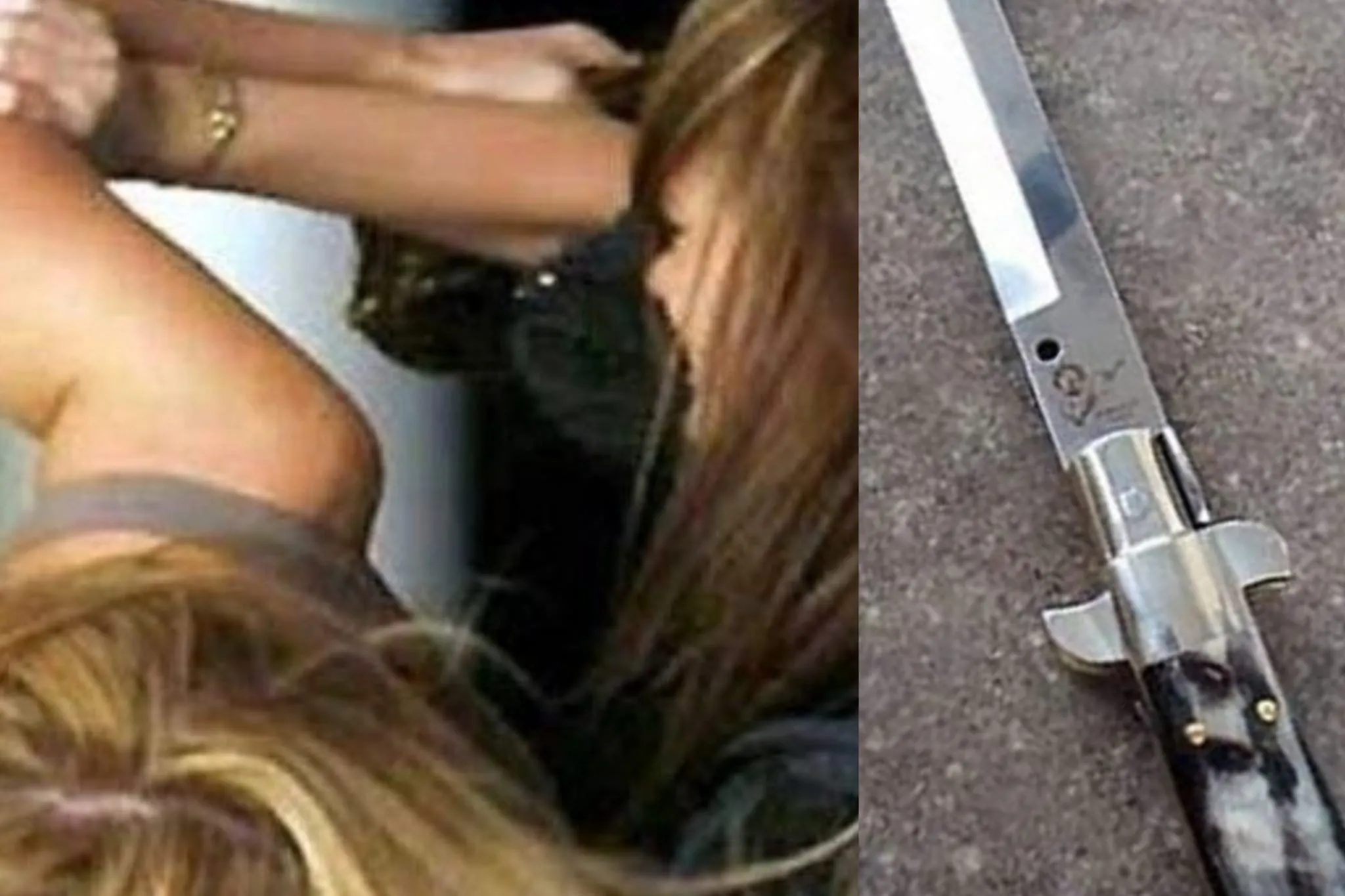 ragazza accoltellata al braccio