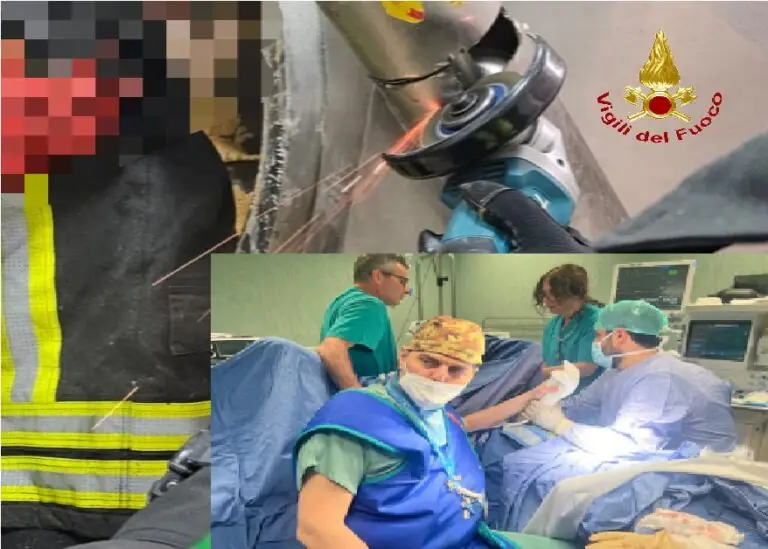 Mano schiacciata nella macchina del gelato, intervento miracoloso per ricostruirla in tempi record