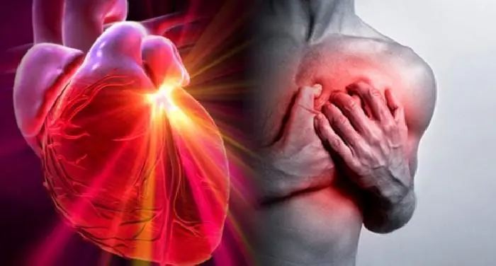 Caldo estremo, aumentano gli infarti: i sintomi nascosti da non sottovalutare