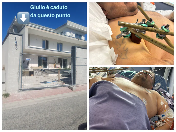 Giulio ancora in gravi condizioni dopo caduta: “Nessun aiuto dalle ditte e dai proprietari della villa”