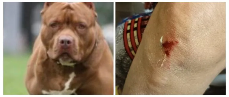 Attimi di terrore: Pitbull aggredisce madre, figlia e il loro cagnolino