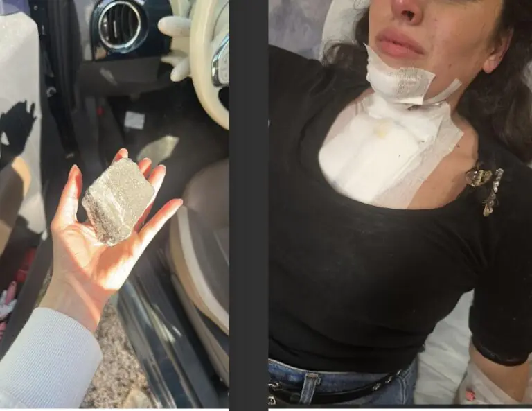 Sasso lanciato sfonda parabrezza e colpisce conducente