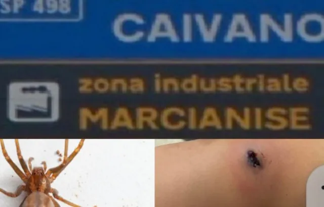 Bimbo di 4 anni morso da ragno, corsa disperata in ospedale