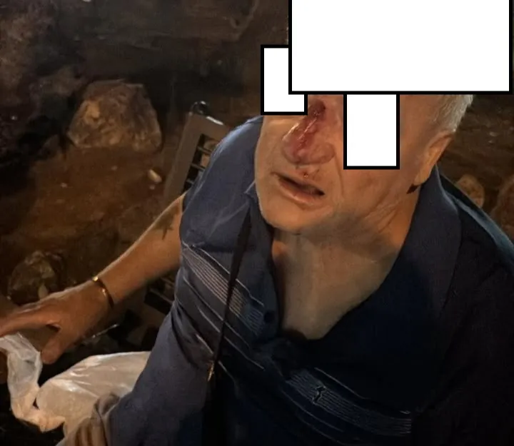 Lo assale in piazza e gli rompe il naso