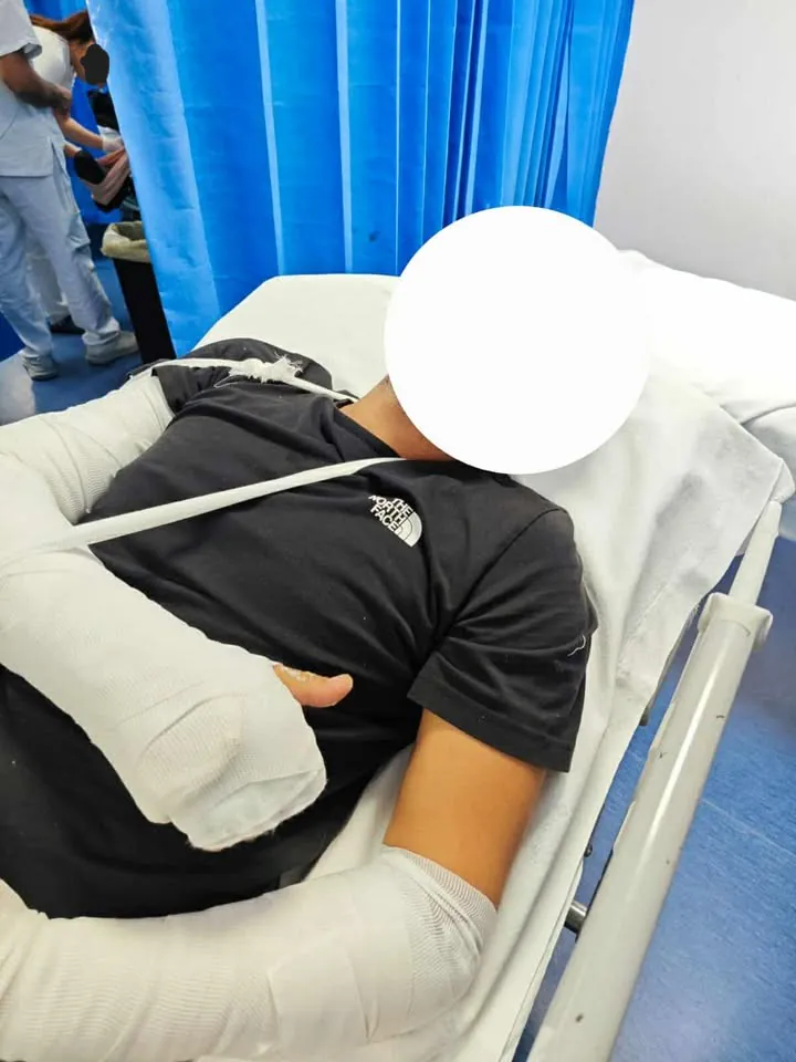 Pestato a sangue e rapinato da giovani in scooter: choc sull’Asse Mediano