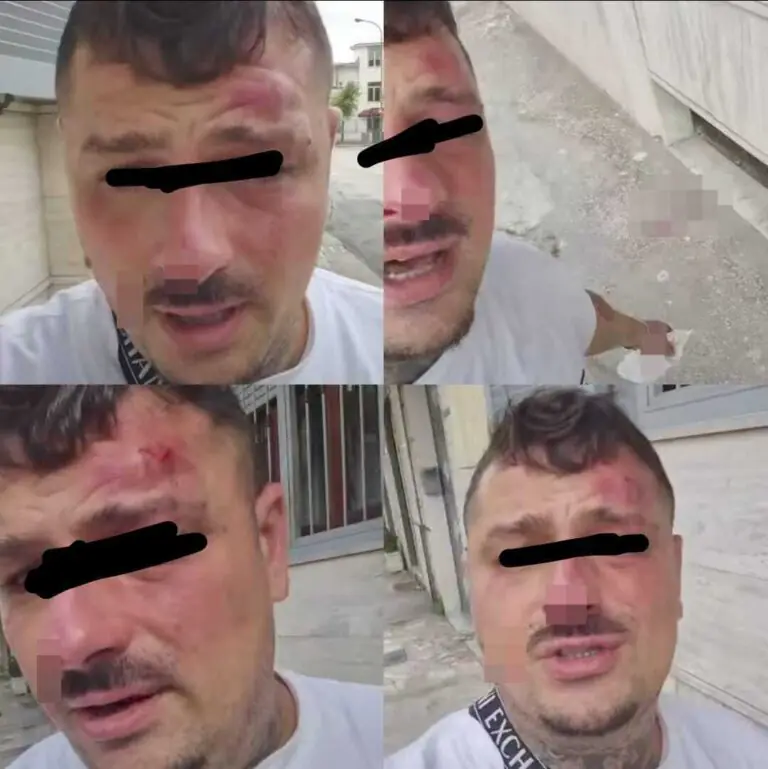 Va a trovare la figlia, lo minacciano con la pistola e lo pestano a sangue dopo inseguimento
