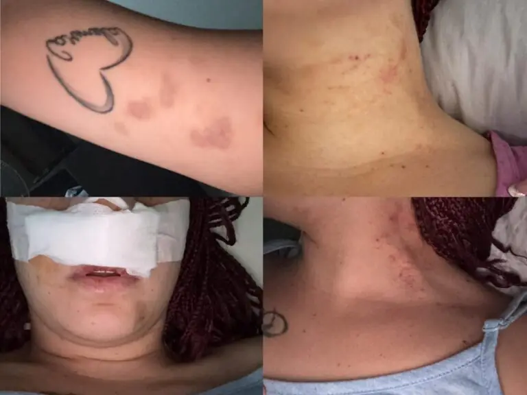 Continue violenze dal compagno: salvata dalla figlia con videochiamata