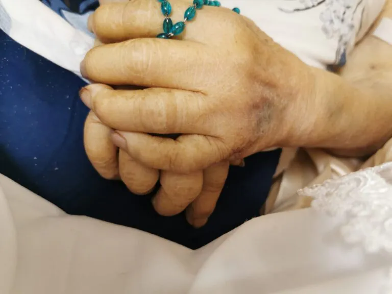 Muore all’ospedale e sparisce la fede nuziale