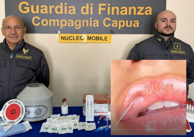 Botox e filler a 100 euro: infermiera trasforma casa in centro estetico illegale