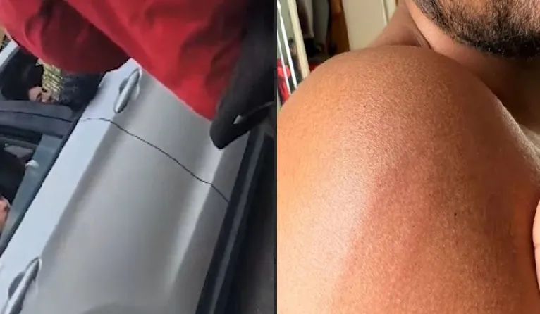 A bordo di un Suv provano a rapinare monopattino. IL VIDEO CHOC