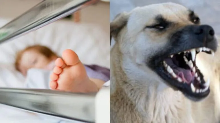 Cane azzanna alla testa bimba di 2 anni: choc alla villa comunale