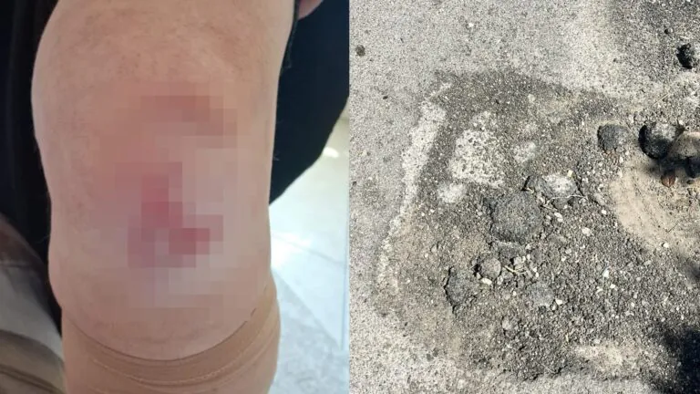 Inciampa in una buca e finisce a terra, paura per una donna