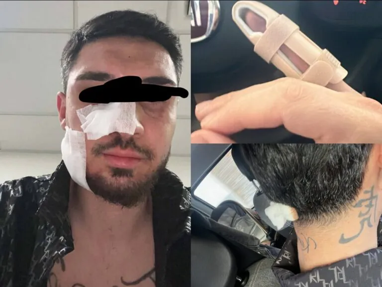 Lo costringono a fermarsi e lo pestano a sangue, choc sull’Asse Mediano