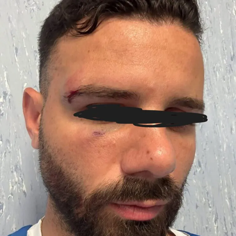 Lo accusa di guardare la moglie e lo aggredisce: choc all’Atm