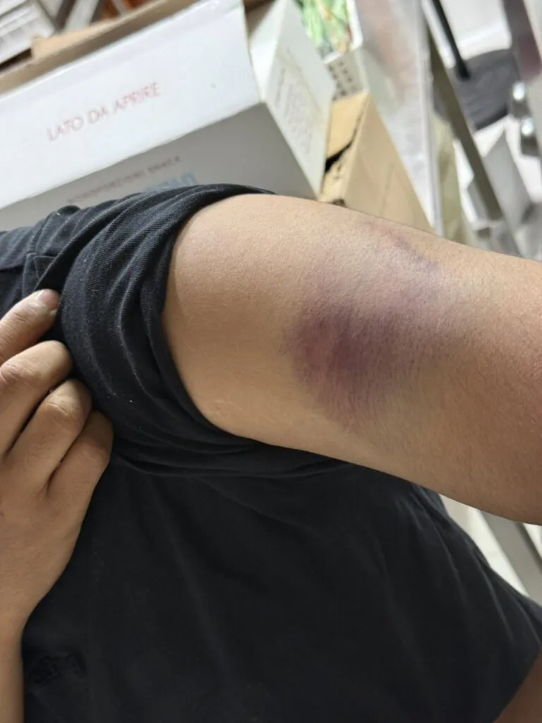 Aggredito con una spranga di ferro mentre va a lavoro, choc in strada