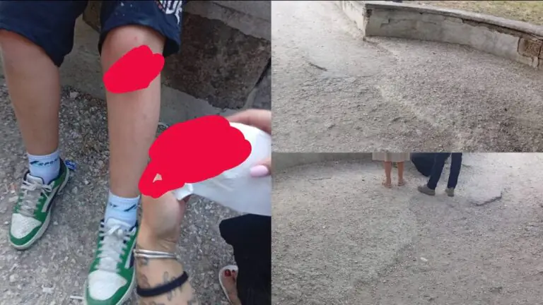 Bimbo cade per l’asfalto danneggiato, paura nei pressi della Villa Comunale