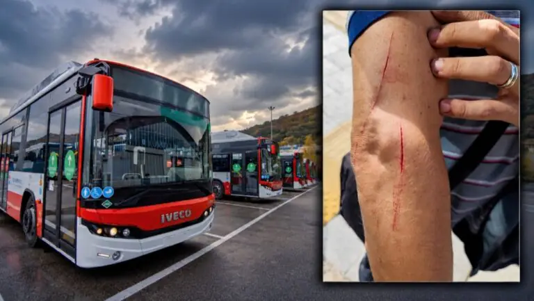 Autista aggredito sul bus: due fendenti a un braccio